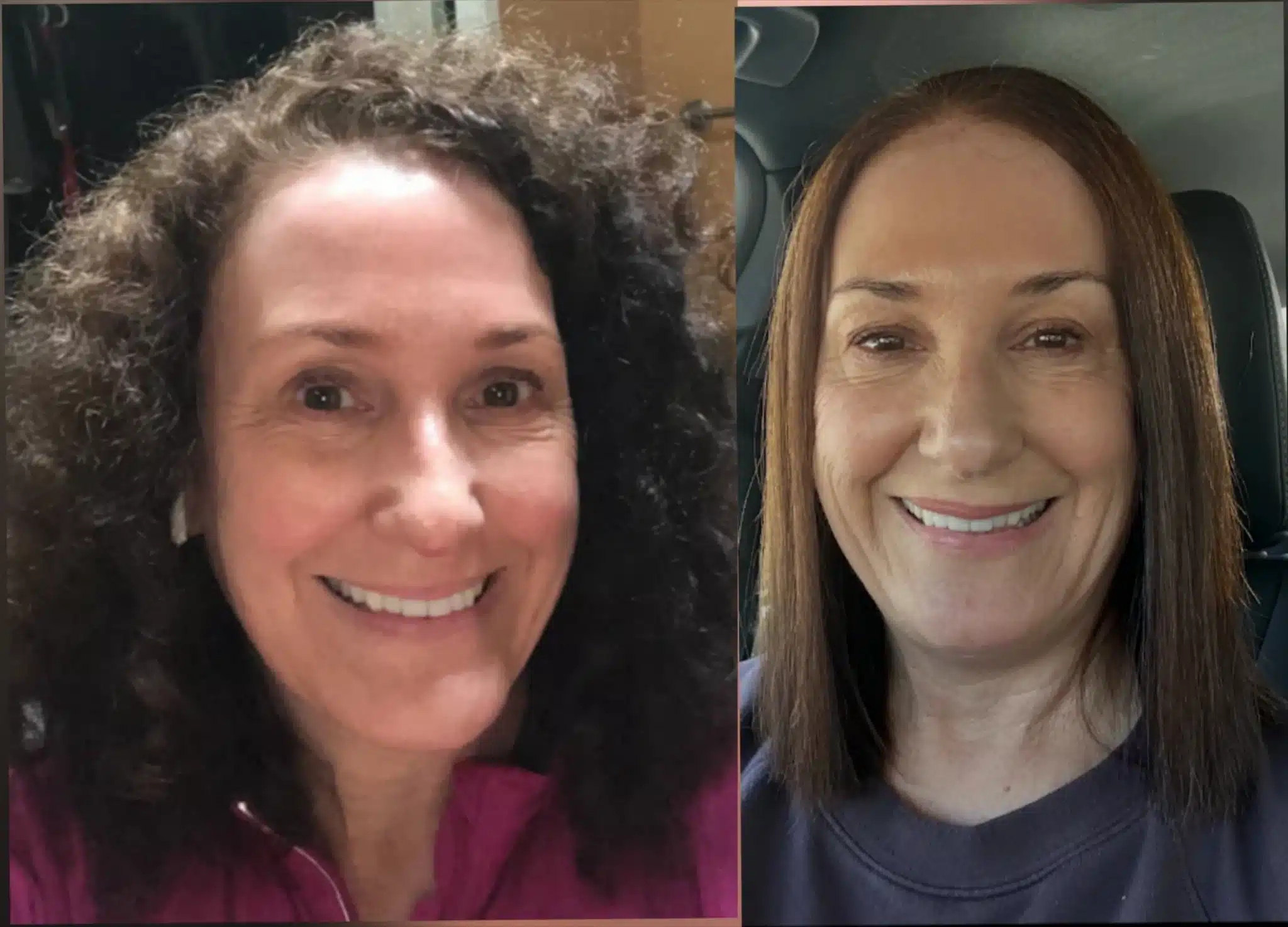Client with smooth, frizz-free hair after hair botox treatment